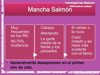 Muy            Cabeza         El vértex o
  frecuentes     Afectando:     la nuca.
  en los RN.                    Color
                 La parte
  40-70%         media de la    rosado y se
  incidencia     frente y los   hace más
                 parpados.      evidente
                                con el llanto.

• Generalmente desaparecen en el primer
  año de vida.
 
