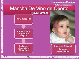 Color rojo
0.5% de los RN
vivo, vinoso
 o violáceo.


Afecta Frente,
 Superficie
 párpados y
     lisa
   mejilla




   Lesión
  Unilateral     Puede ser Bilateral.
 siguiendo el
congenita y
  Trigémino.          Tronco y
  estable          extremidades.
 
