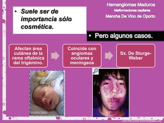 • Suele ser de
   importancia sólo
   cosmética.


 Afectan área     Coincide con
 cutánea de la     angiomas      Sx. De Sturge-
rama oftalmica     oculares y        Weber
 del trigémino.    meningeos
 