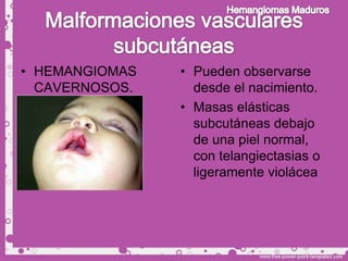 • HEMANGIOMAS   • Pueden observarse
  CAVERNOSOS.     desde el nacimiento.
                • Masas elásticas
                  subcutáneas debajo
                  de una piel normal,
                  con telangiectasias o
                  ligeramente violácea
 