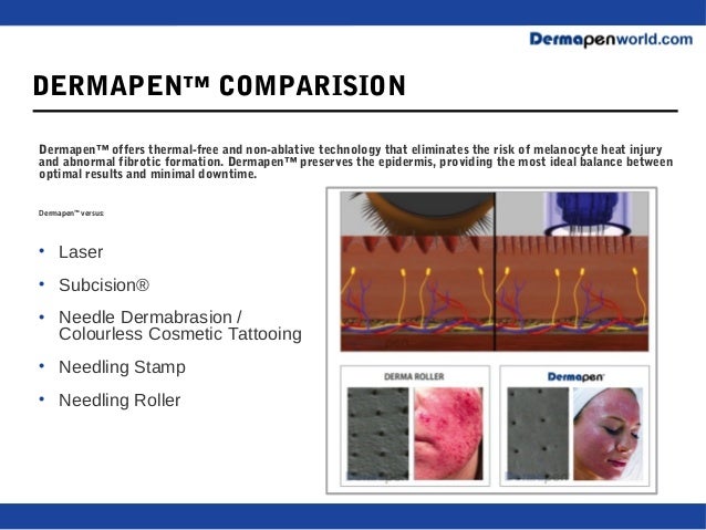 Denver Dermapen Training Debbie Brinkman Denver Dermapen Training Debbie Brinkman