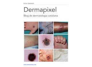 ROSA TABERNER 
Dermapixel 
Blog de dermatología cotidiana 
WWW.DERMAPIXEL.COM 
 