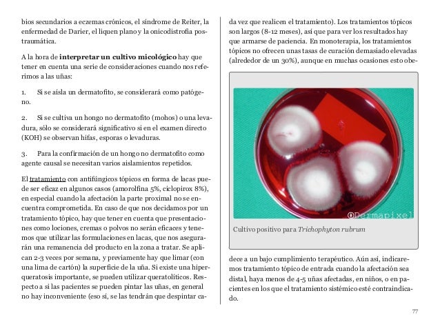 Dermapixel Blog De Dermatologia Cotidiana Pdf