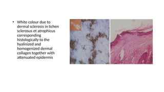 Dermal Homogenization Dermoscopy in Dermatology: Principles, Patterns, and Clinical ...