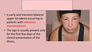 Derma signs | PPTX