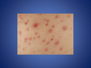 Plect Dermatology made easy | PPTX