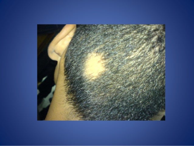 dermatology made easy pdf download