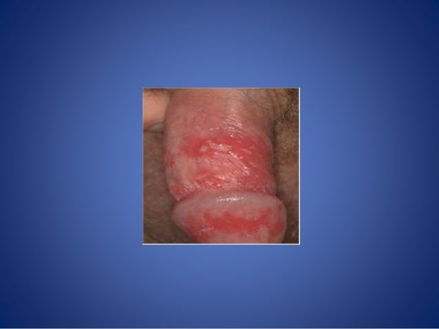 Dermatology made easy