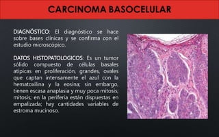 DIAGNÓSTICO: El diagnóstico se hace
sobre bases clínicas y se confirma con el
estudio microscópico.
DATOS HISTOPATOLOGICOS: Es un tumor
sólido compuesto de células basales
atípicas en proliferación, grandes, ovales
que captan intensamente el azul con la
hematoxilina y la eosina; sin embargo,
tienen escasa anaplasia y muy poca mitosis;
mitosis; en la periferia están dispuestas en
empalizada; hay cantidades variables de
estroma mucinoso.
 