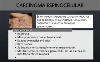 CARCINOMA ESPINOCELULAR
ES UN TUMOR MALIGNO DE LOS QUERATINOCITOS
QUE SE ORIGINA EN LA EPIDERMIS, LOS ANEXOS
CUTÁNEOS Y LA MUCOSA ESCAMOSA
ESTRATIFICADA.
• Imprecisa
• Menos frecuente que el basocelular
• Edades avanzadas (40 años)
• Raza blanca
• Se Localiza fundamentalmente en extremidades.
• Más frecuente en varones, pero el CEC de las piernas en
más frecuente en mujeres.
•
Epidemiología
 