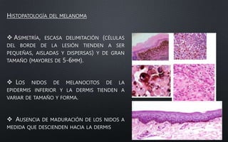 HISTOPATOLOGÍA DEL MELANOMA
 ASIMETRÍA, ESCASA DELIMITACIÓN (CÉLULAS
DEL BORDE DE LA LESIÓN TIENDEN A SER
PEQUEÑAS, AISLADAS Y DISPERSAS) Y DE GRAN
TAMAÑO (MAYORES DE 5-6MM).
 LOS NIDOS DE MELANOCITOS DE LA
EPIDERMIS INFERIOR Y LA DERMIS TIENDEN A
VARIAR DE TAMAÑO Y FORMA.
 AUSENCIA DE MADURACIÓN DE LOS NIDOS A
MEDIDA QUE DESCIENDEN HACIA LA DERMIS
 