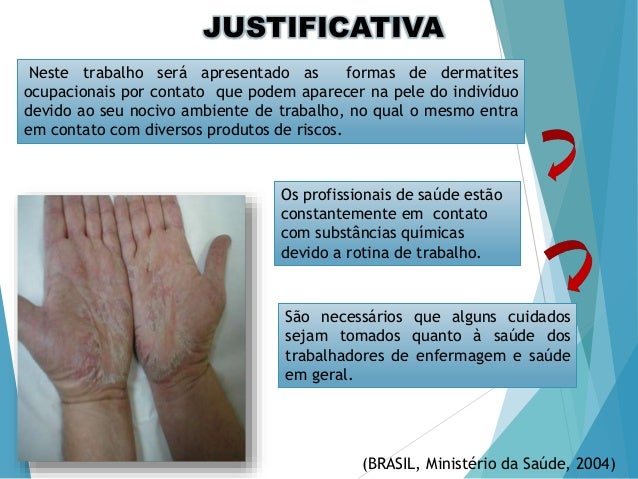 Doenças ocupacionais enfermagem do trabalho Doenças ocupacionais enfermagem do trabalho