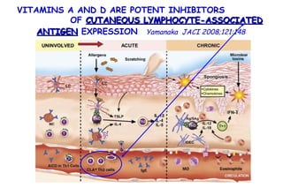 VITAMINS A AND D ARE POTENT INHIBITORS  OF  CUTANEOUS LYMPHOCYTE-ASSOCIATED ANTIGEN  EXPRESSION   Yamanaka  JACI 2008;121:148 