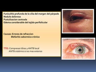 Funicularitis Dermatitis | PPTX