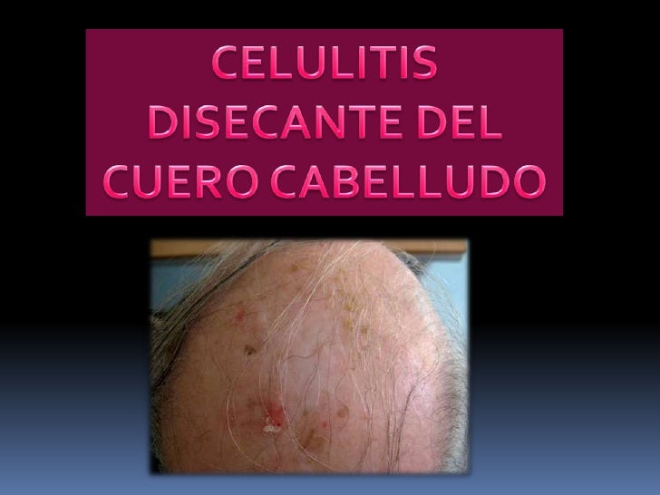 Dermatitis