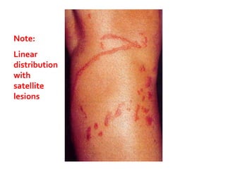 Dermatitis | PPTX