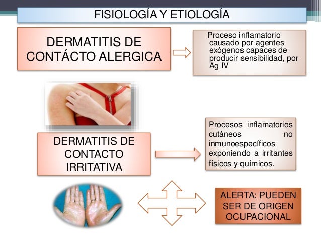 Los sanatorios kislovodska el tratamiento de la psoriasis