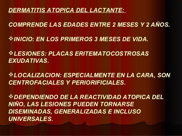 Que ungüento ayuda de la eccema en las manos