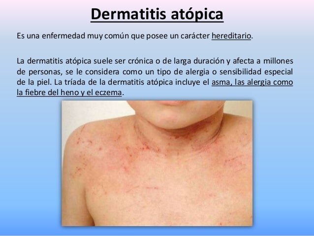 Dermatitis