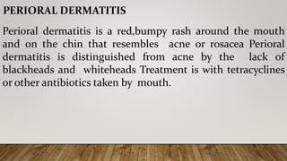 PERIORAL DERMATITIS
Perioral dermatitis is a red,bumpy rash around the mouth
and on the chin that resembles acne or rosacea Perioral
dermatitis is distinguished from acne by the lack of
blackheads and whiteheads Treatment is with tetracyclines
or other antibiotics taken by mouth.
 