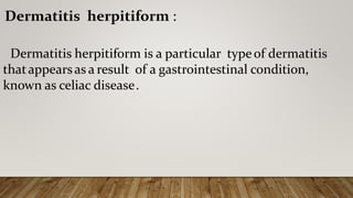 Dermatitis herpitiform :
Dermatitis herpitiform is a particular typeof dermatitis
thatappearsas a result of a gastrointestinal condition,
known as celiac disease.
 