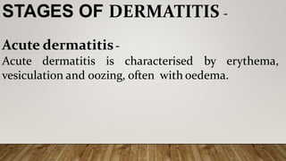 STAGES OF DERMATITIS -
Acute dermatitis-
Acute dermatitis is characterised by erythema,
vesiculation and oozing, often with oedema.
 