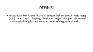 DEFINISI
• Peradangan kuit kronis ditandai dengan lesi berbentuk mata uang
(koin) atau agak lonjong, berbatas tegas dengan efloresensi
papulovesikel yang biasanya mudah pecah sehingga membasah.
 