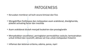 PATOGENESIS
• Kerusakan membran sel kulit secara kimiawi dan fisis
• Mengaktifkan fosfolipase dan melepaskan asam arakidonat, diasilgliserida,
platelet activating factor dan inositida
• Asam arakidonat diubah menjadi leukotrien dan prostaglandin
• Menyebabkan vasodilatasi, peningkatan permeabilitas vaskular, kemoatraktan
untuk limfosit dan neutrofil, aktivasi sel mas untuk melepaskan histamin
• Inflamasi dan kelainan eritema, edema, panas, nyeri
 