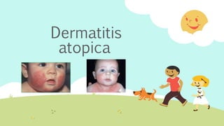 Dermatitis
atopica
 