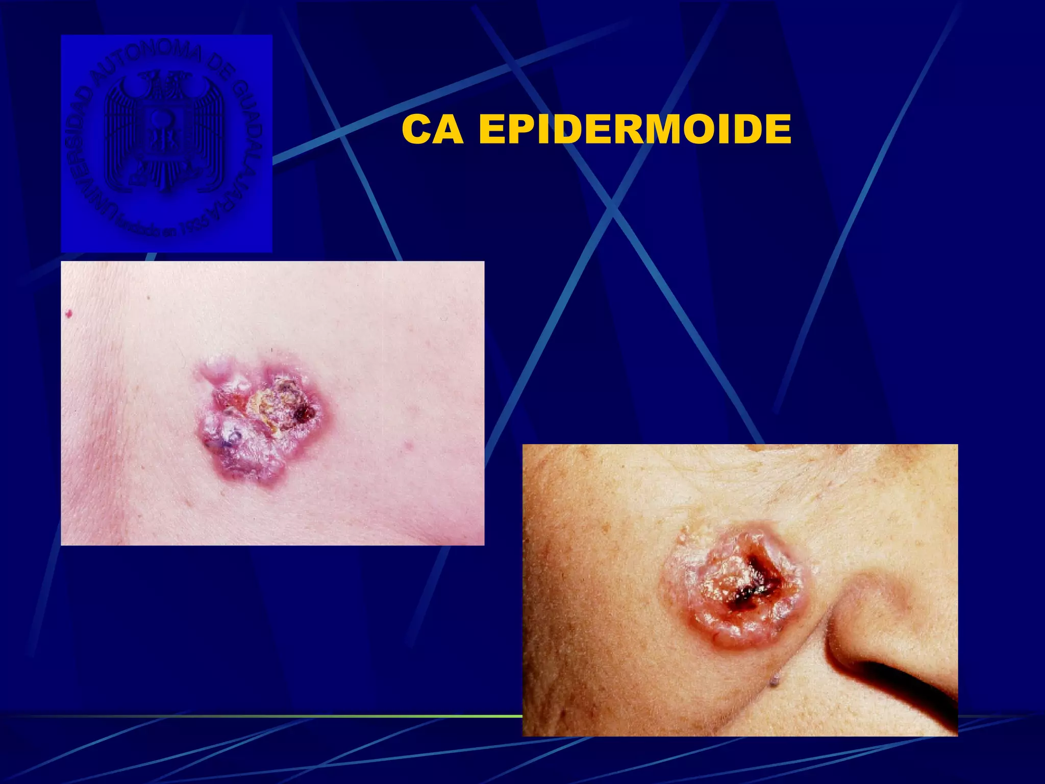 Dermatitis Por Medicamentos (Farmacodermias ) | PPT