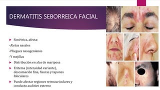 DERMATITIS SEBORREICA FACIAL
 Simétrica, afecta:
-Aletas nasales
-Pliegues nasogenianos
-Y mejillas
 Distribución en alas de mariposa
 Eritema (intensidad variante),
descamación fina, fisuras y tapones
foliculares
 Puede afectar regiones retroauriculares y
conducto auditivo externo
 