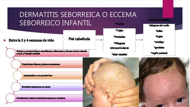 La psoriasis los síntomas de la diferencia
