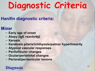Diagnostic Criteria
Hanifin diagnostic criteria:
Minor
– Early age of onset
– Atopy (IgE reactivity)
– Xerosis
– Keratosis pilaris/ichthyosis/palmar hyperlinearity
– Atypical vascular responses
– Perifollicular changes
– Ocular/periorbital changes
– Perioral/periauricular lesions
Diagnosis 11
 