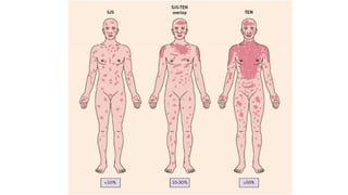 Dermatitis Problem Dermatitis and skin problem in medical health.pptx