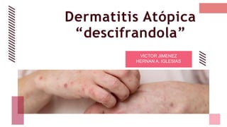 Dermatitis Atópica
“descifrandola”
VICTOR JIMENEZ
HERNAN A. IGLESIAS
 