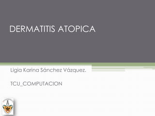 DERMATITIS ATOPICA Ligia Karina Sánchez Vázquez. TCU_COMPUTACION 