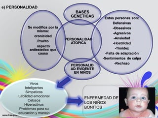 e) PERSONALIDADe) PERSONALIDAD
Vivos
Inteligentes
Simpaticos
Labilidad emocional
Celosos
Hiperactivos
Problemas para su
educacion y manejo
ENFERMEDAD DE
LOS NIÑOS
BONITOS
 