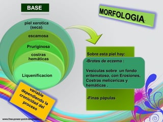 Sobre esta piel hay:Sobre esta piel hay:
-Finas pápulas-Finas pápulas
variable
variable
dependiendo la
dependiendo la
cronicidad del
cronicidad del
proceso
proceso
-Brotes de eczema :-Brotes de eczema :
Vesículas sobre un fondoVesículas sobre un fondo
eritematoso, con Erosiones,eritematoso, con Erosiones,
Costras melicericas yCostras melicericas y
hemáticas .hemáticas .
 
