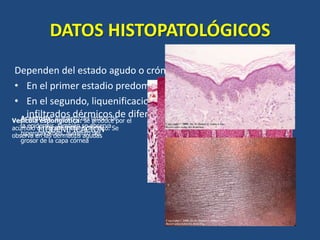 Dermatitis atopica | PPTX