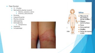  Fase Escolar
 4 - 14 años
 Dermatitis plantar juvenil
 Plantas, pulpejos y dorso
 Eritema y descamación
 Eccema
 Liquenificación
 Prurito intenso
 Adenopatías
 Eritrodermia
 Temperatura
 Insomnio
 Irritabilidad
 