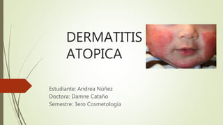 DERMATITIS
ATOPICA
Estudiante: Andrea Núñez
Doctora: Damne Cataño
Semestre: 3ero Cosmetología
 
