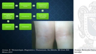 Alumno: Bermudez Garcia
Salvador
Arenas, R. “Dermatología, Diagnóstico y Tratamiento, 5ta Edición, Mc Graw Hill,
México 2015
 
