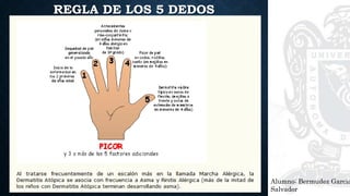 REGLA DE LOS 5 DEDOS
Alumno: Bermudez Garcia
Salvador
 