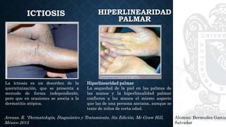 Alumno: Bermudez Garcia
Salvador
Arenas, R. “Dermatología, Diagnóstico y Tratamiento, 5ta Edición, Mc Graw Hill,
México 2015
ICTIOSIS
La ictiosis es un desorden de la
queratinización, que se presenta a
menudo de forma independiente,
pero que en ocasiones se asocia a la
dermatitis atópica.
HIPERLINEARIDAD
PALMAR
Hiperlinearidad palmar
La sequedad de la piel en las palmas de
las manos y la hiperlinealidad palmar
confieren a las manos el mismo aspecto
que las de una persona anciana, aunque se
trate de niños de corta edad.
 