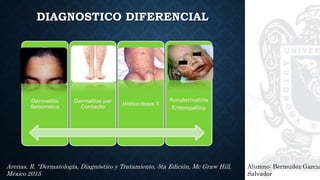 DIAGNOSTICO DIFERENCIAL
Alumno: Bermudez Garcia
Salvador
Arenas, R. “Dermatología, Diagnóstico y Tratamiento, 5ta Edición, Mc Graw Hill,
México 2015
 