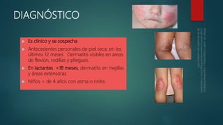 DIAGNÓSTICO
 Es clínico y se sospecha
 Antecedentes personales de piel seca, en los
últimos 12 meses. Dermatitis visibles en áreas
de flexión, rodillas y pliegues.
 En lactantes <18 meses, dermatitis en mejillas
y áreas extensoras.
 Niños < de 4 años con asma o rinitis.
 