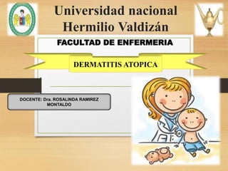 Universidad nacional
Hermilio Valdizán
FACULTAD DE ENFERMERIA
DOCENTE: Dra. ROSALINDA RAMIREZ
MONTALDO
DERMATITIS ATOPICA
 