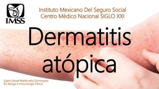 Dermatitis
atópica
Instituto Mexicano Del Seguro Social
Centro Médico Nacional SIGLO XXI
Edwin Daniel Maldonado Domínguez
R2 Alergia e Inmunología Clínica
 