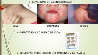 LEVE MODERADA SEVERA
 IMPACTO EN LA CALIDAD DE VIDA
 BIENESTAR PSICOLÓGICO DEL PACIENTE Y LA FAMILIA
 SEVERIDAD DE LA ENFERMEDAD
 