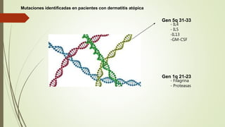 Gen 5q 31-33
- IL4
- IL5
-IL13
-GM-CSF
Gen 1q 21-23
- Filagrina
- Proteasas
Mutaciones identificadas en pacientes con dermatitis atópica
 